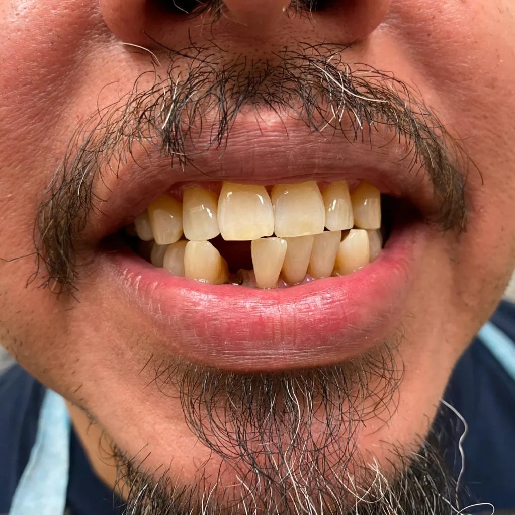 Before